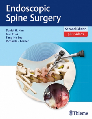 Endoscopic Spine Surgery 2nd edition