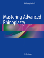 Mastering Advanced Rhinoplasty