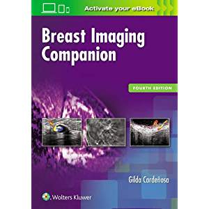Breast Imaging Companion, 4e 