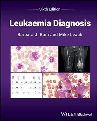 Leukaemia Diagnosis 6th Edition