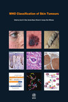 WHO Classification of Skin Tumours. Fourth Edition