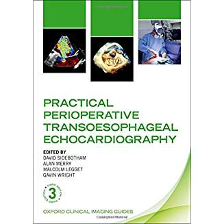 Practical Perioperative Transoesophageal Echocardiography -3rd Edition