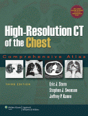 High-Resolution CT of the Chest