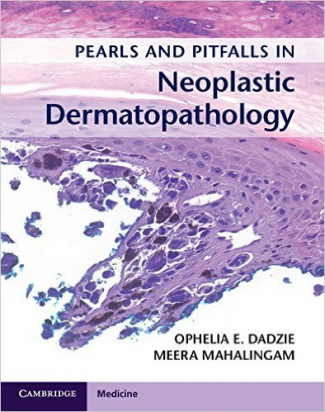 Pearls and Pitfalls in Neoplastic Dermatopathology