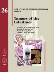 AFIP 4  Fasc. 26 Tumors of the Intestines