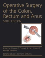 Operative Surgery of the Colon, Rectum and Anus, Sixth Edition