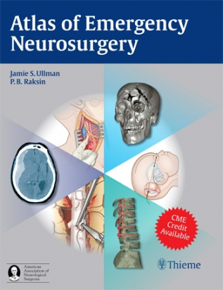 Atlas of Emergency Neurosurgery