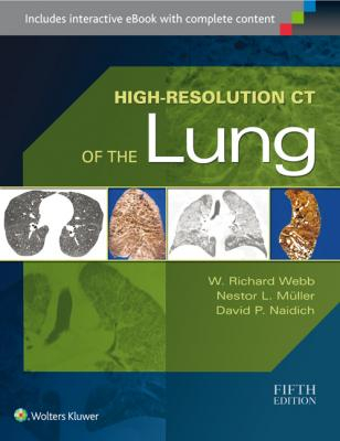 High-Resolution CT of the Lung, 5e 