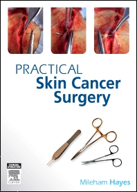 Practical Skin Cancer Surgery, 1st Edition