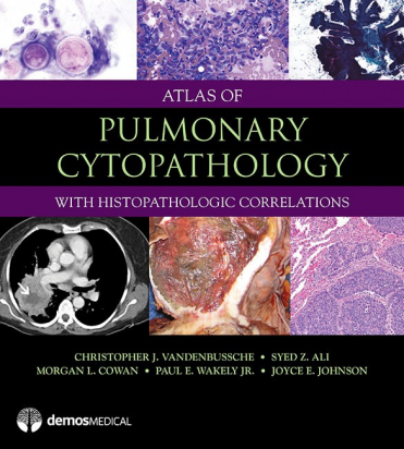 Atlas of Pulmonary Cytopathology