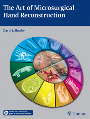 The Art of Microsurgical Hand Reconstruction 