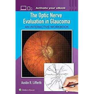 The Optic Nerve Evaluation in Glaucoma 