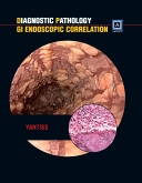 Diagnostic Pathology: GI Endoscopic Correlations 
