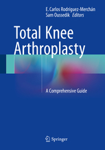 Total Knee Arthroplasty