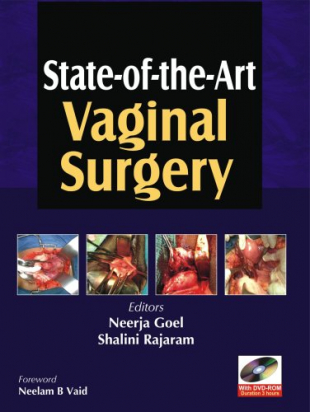State-of-the-Art Vaginal Surgery, 2nd ed