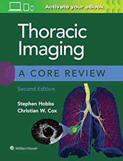 Thoracic Imaging: A Core Review Second edition