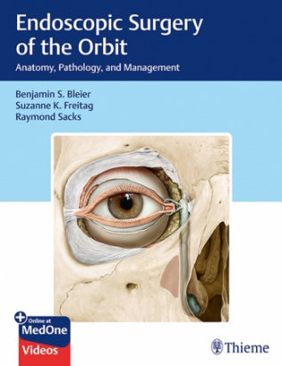 Endoscopic Surgery of the Orbit