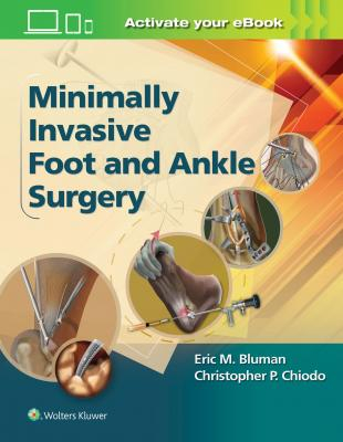 Minimally Invasive Foot &amp; Ankle Surgery 