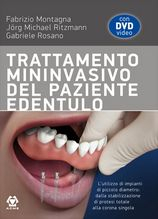 Trattamento mininvasivo del paziente edentulo