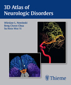 3D Atlas of Neurologic Disorders DVD