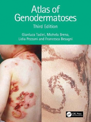 Atlas of Genodermatoses 3rd edition