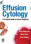 Effusion Cytology A Practical Guide to Cancer Diagnosis