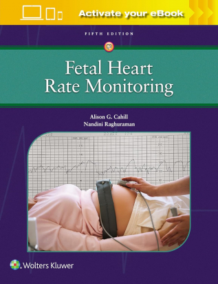 Fetal Heart Rate Monitoring Fifth edition