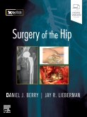 Surgery of the Hip, 2nd Edition