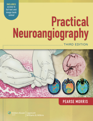 Practical Neuroangiography