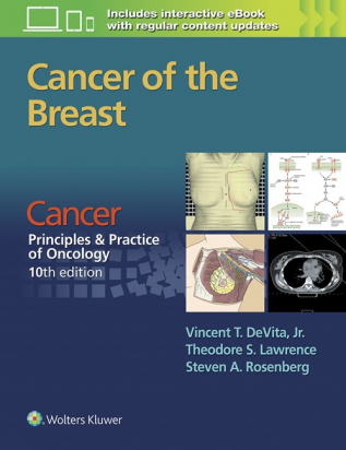 Cancer of the Breast 10th ed