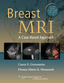 Breast MRI