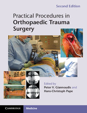 Practical Procedures in Orthopaedic Trauma Surgery, 2nd ed