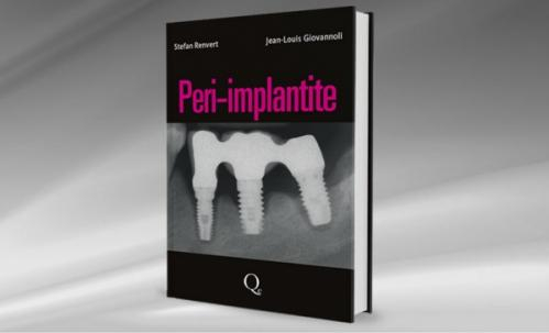 Peri-Implantite