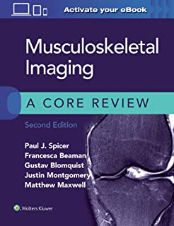Musculoskeletal Imaging: A Core Review Musculoskeletal Imaging 2nd edition