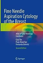 Fine Needle Aspiration Cytology of the Breast