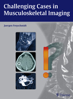 Challenging Cases in Musculoskeletal Imaging 