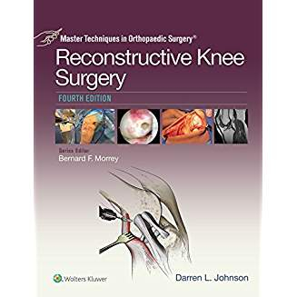 Master Techniques in Orthopaedic Surgery: Reconstructive Knee Surgery, 4e 