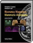 Risonanza magnetica mammaria abbreviata