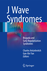 J Wave Syndromes