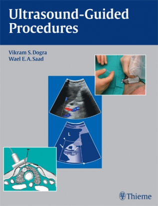 Ultrasound-Guided Procedures