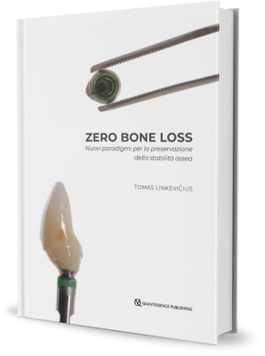 Zero Bone Loss