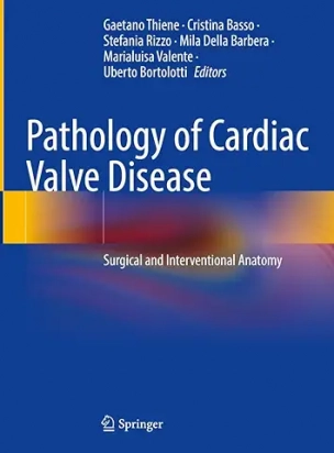 Pathology of Cardiac Valve Disease