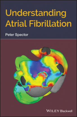 Understanding Atrial Fibrillation