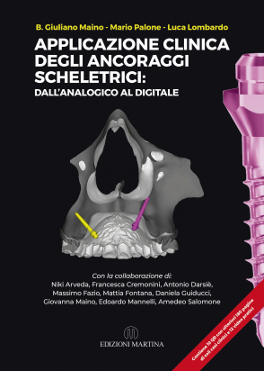 Applicazione Clinica degli Ancoraggi Scheletrici
