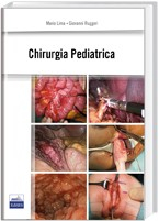 Chirurgia Pediatrica