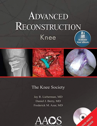 Advanced Reconstruction: Knee: Print + Ebook with Multimedia Advanced Reconstruction