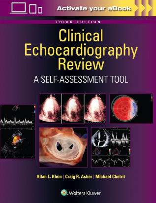 Clinical Echocardiography Review A Self-Assessment Tool, Third edition