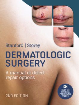 Dermatologic Surgery, 2nd Edition