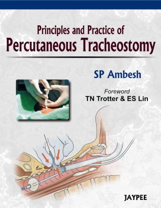 Principles and Practice of Percutaneous Tracheostomy