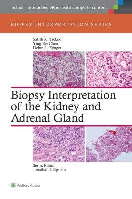 Biopsy Interpretation of the Kidney and Adrenal Gland